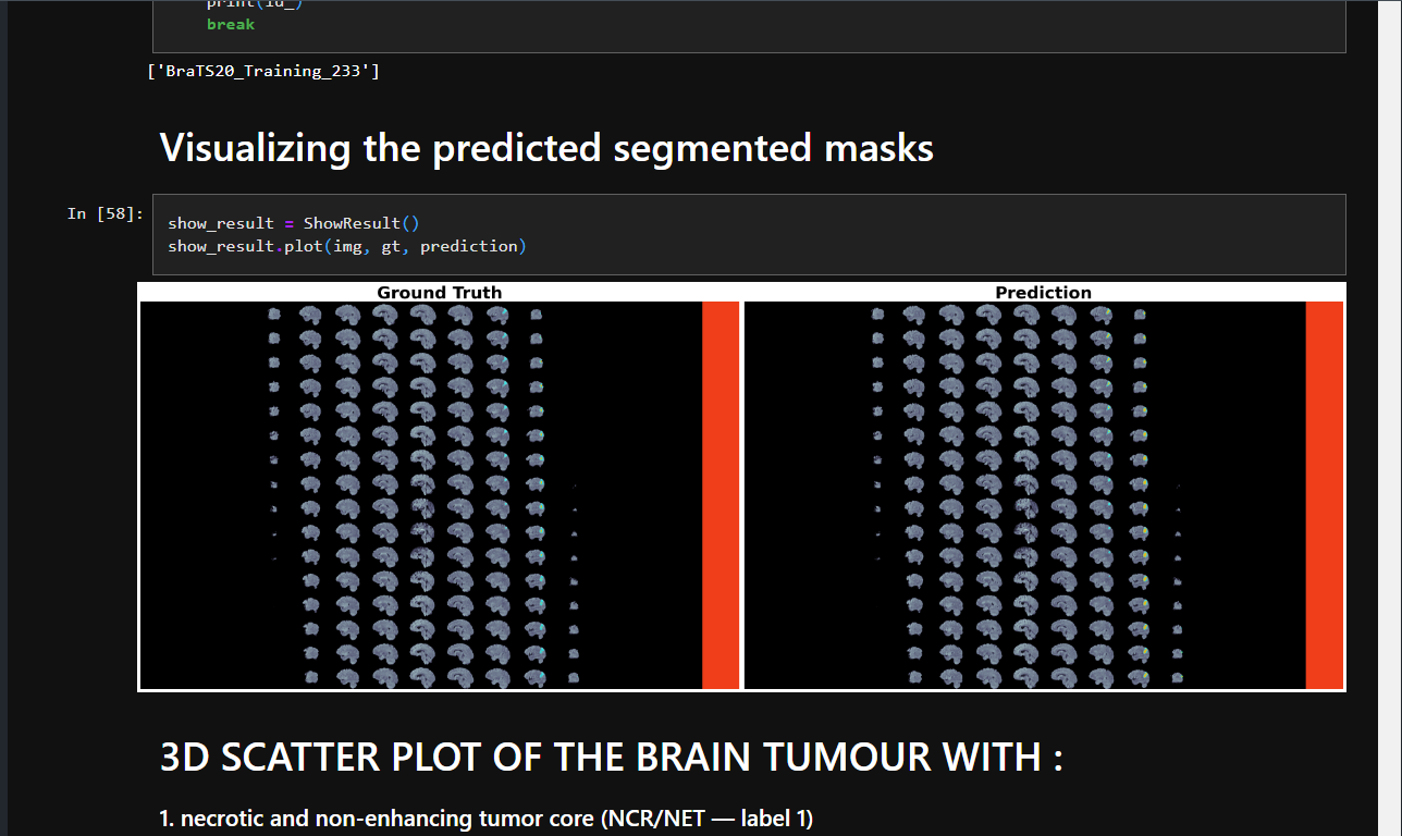 Brain Tumor Segmentation Project