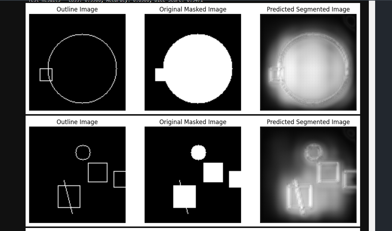 Unet Segmentation Project